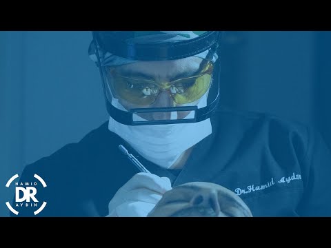 Saç ekiminde fiyatlandırma nasıl olmalı? Dr. Hamid AYDIN