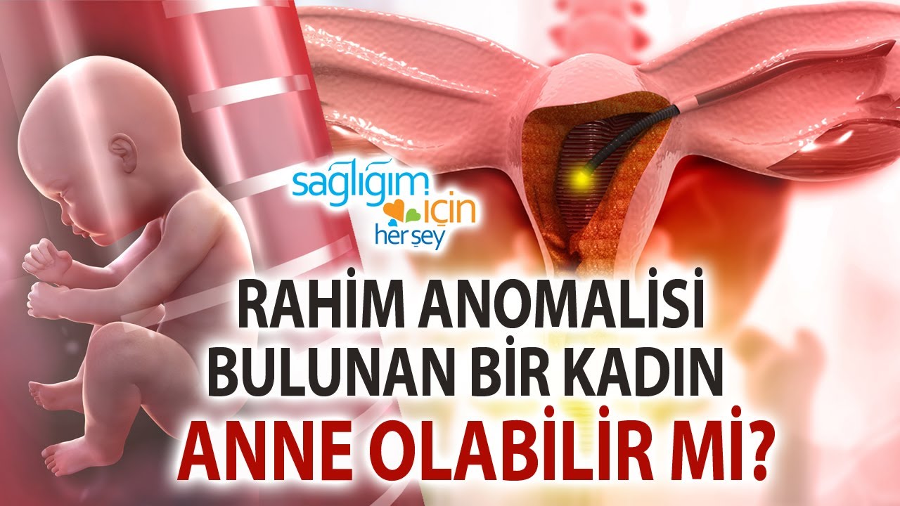 Rahim Şekil Bozuklukları ve Tedavisi