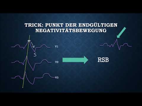 EKG Crashkurs all in one