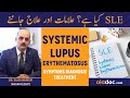 Systemic Lupus Erythematosus Causes Symptoms Treatment Autoimmune Disease SLE Kya Hai Alamat Ilaj