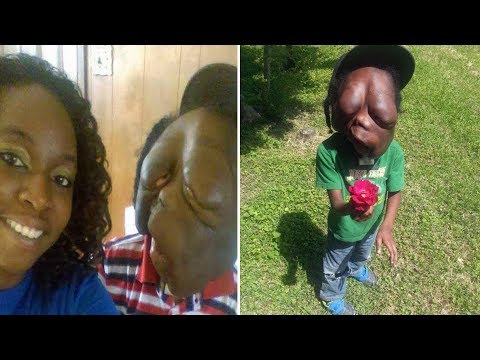 Morbidly Obese Amber Rachdi loses HALF her body weight ...