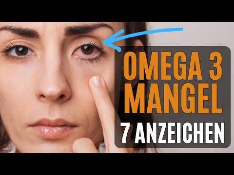 7 Anzeichen für Omega 3 Mangel: 75% der Deutschen betroffen - Ignoriere diese Symptome nicht!