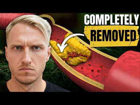 JUST IN: This Crazy Food Completely Removes Plaque from Arteries!