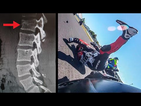 COME HO FATTO A CADERE? TORNERÒ A CORRERE? - Analizzo l'incidente di Misano e racconto il ricovero