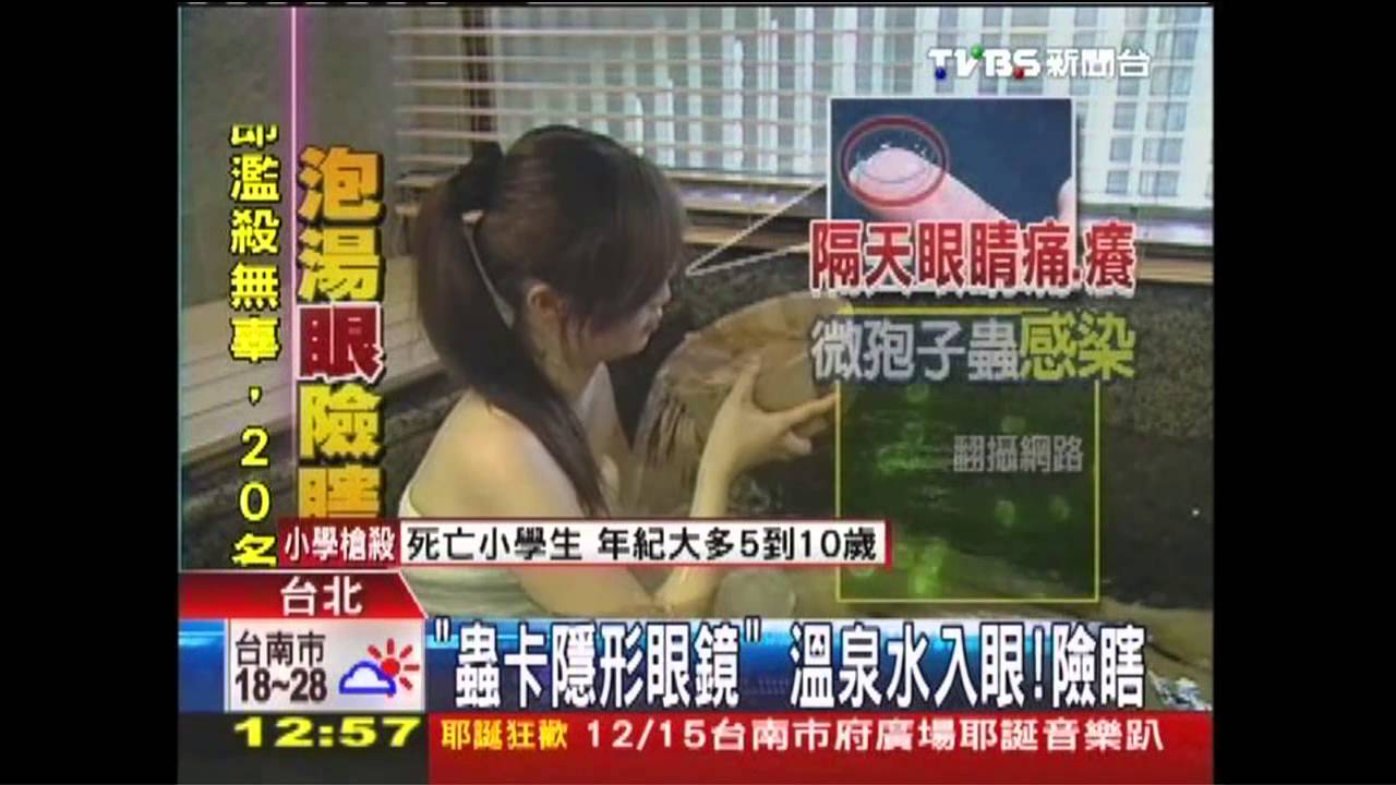 「蟲卡隱形眼鏡」　溫泉水入眼！險瞎