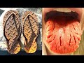 Most Uncomfortable Things You’ll Ever See - BE AMAZED Most Uncomfortable Things You’ll Ever See