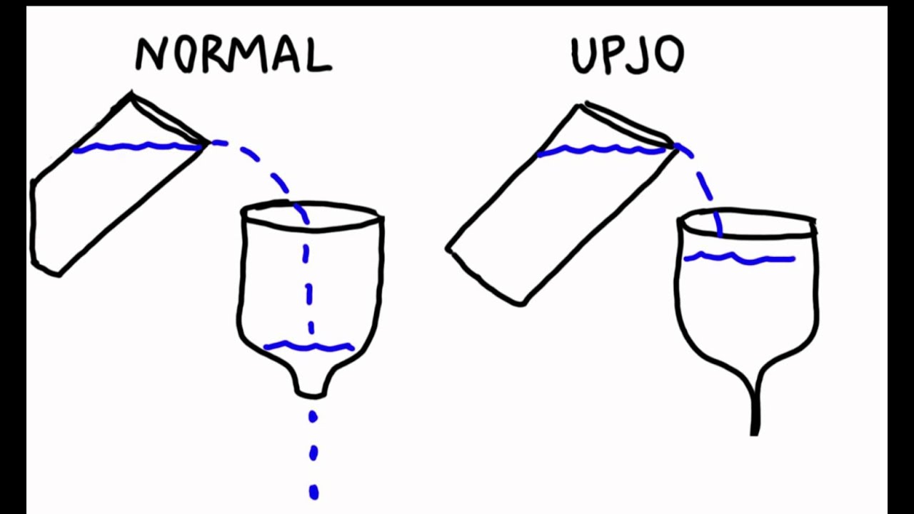 U-M Pediatric Urology - Ureteropelvic Junction Obstruction