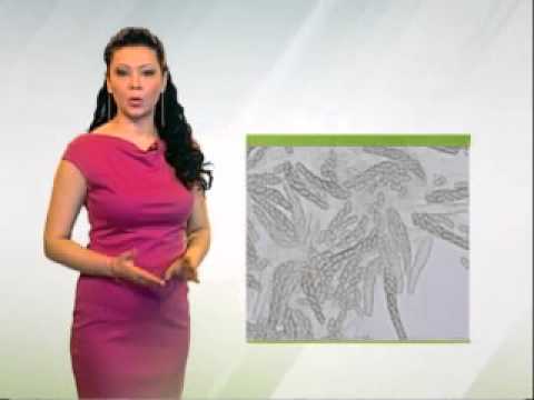 Zelena prognoza 16.3.2015. _ Stanje u zasadima jabuka