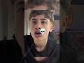 Kylie Jenner Lip Challenge GONE WRONG Funny SHORTS Skull