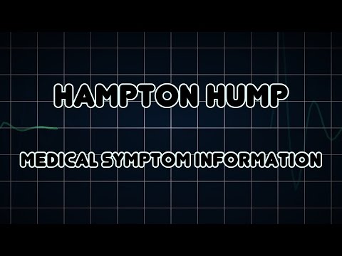 Hampton hump (Medical Symptom)