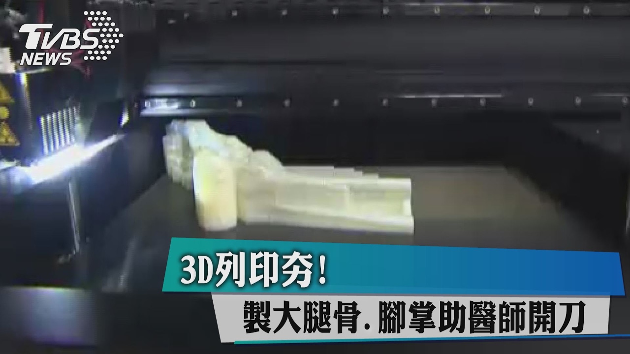 3D列印夯！　製大腿骨、腳掌助醫師開刀
