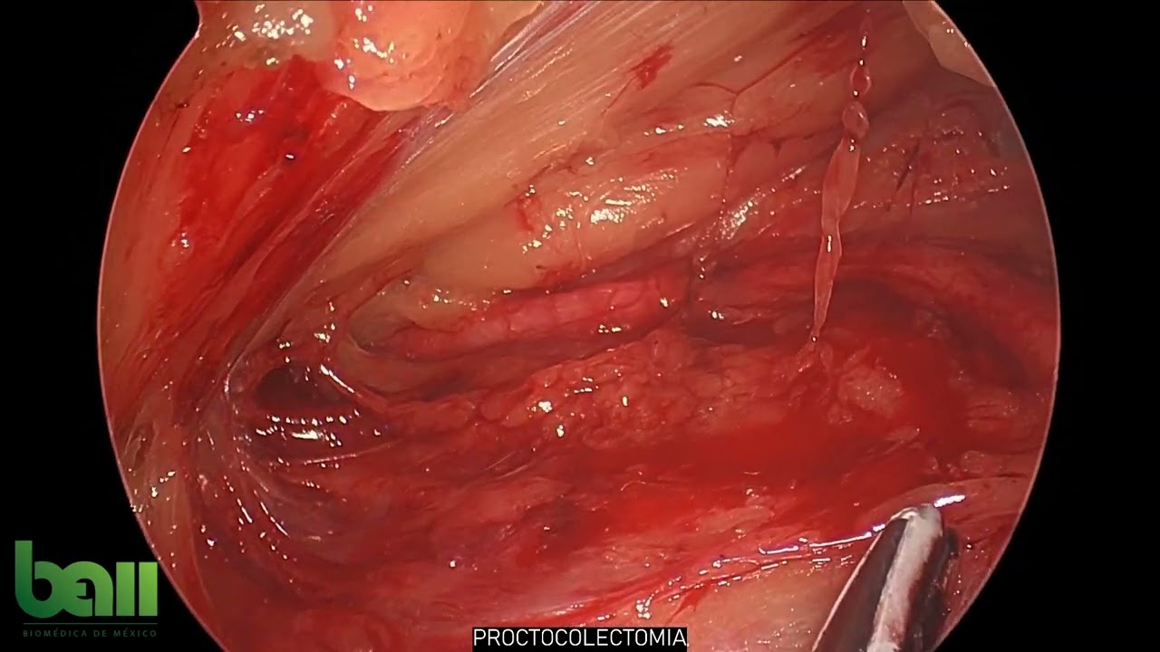 José Angel López Arroyo-1