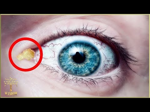 Din cauza a ceea ce elevii dilatate?