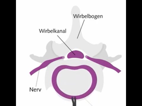 Bandscheibenvorfall Hals- und Brustwirbelsäule