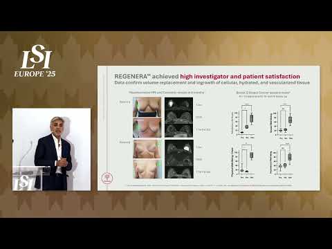Sanjay Kakkar, Tensive - Bioabsorbable Implant Regeneration | LSI Europe '25