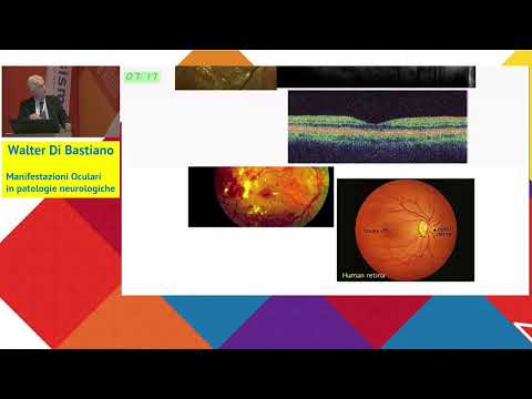 Manifestazioni oculari in patologie neurologiche