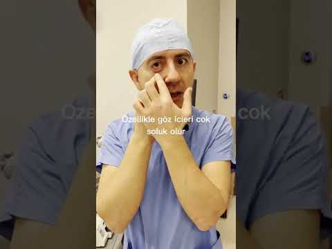 Demir eksikliğinin 10 belirtisi | Dr. Portakal Sağlıklı Yaşam Merkezi