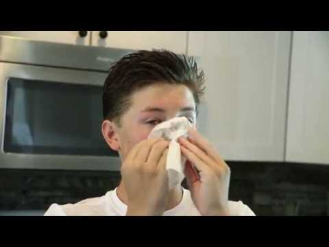 What Causes Nosebleeds