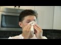 What Causes Nosebleeds