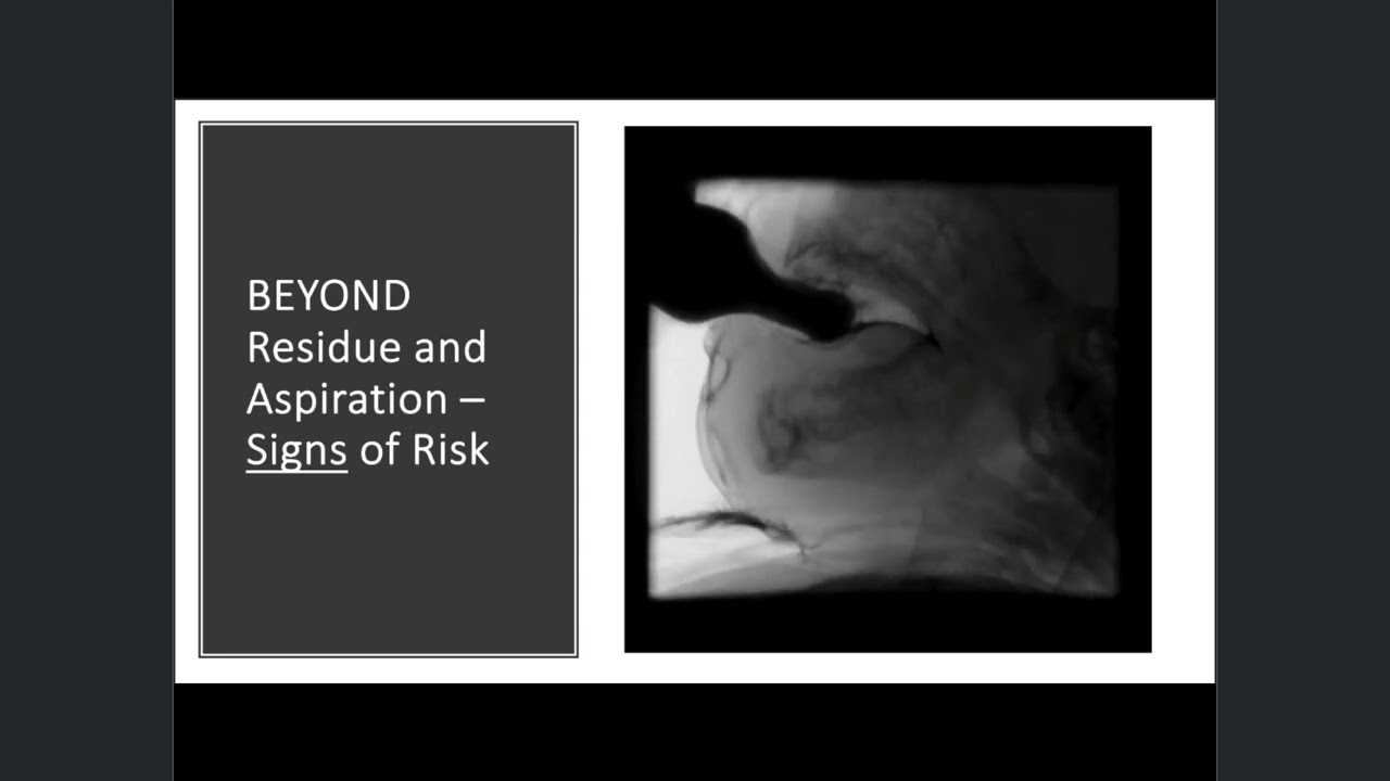 #e002 Preview:BaByVFSImP™ For Videofluoroscopic Assessment Of Swallowing Impairment In Babies