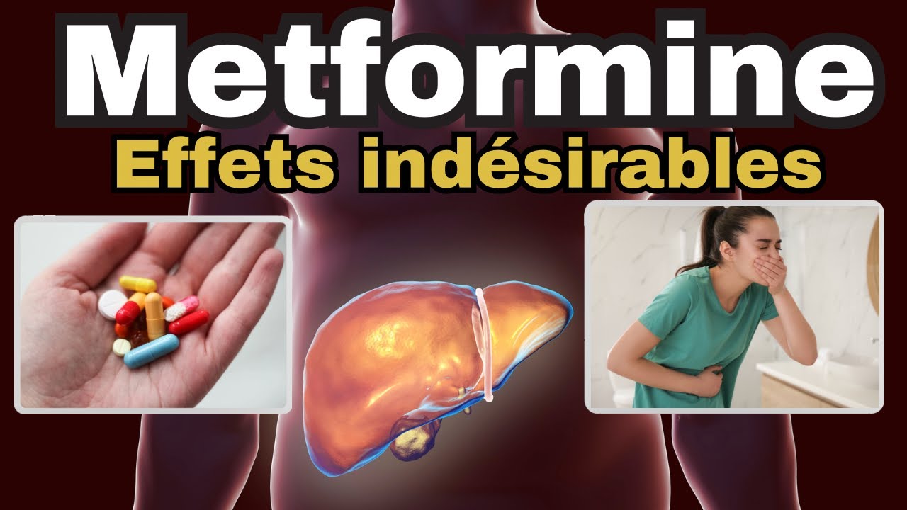 Metformine et ses EFFETS INDESIRABLES à connaître ABSOLUMENT