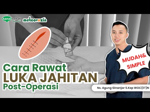 Cara Rawat Luka Jahitan Post-Operasi | Kanal Sehat Metcovazin