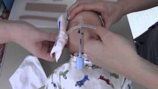 NICU Neobar Method