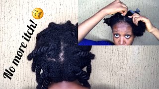preview picture of video 'How To Alleviate Itchy & Dry Scalp Plus Dandruff Using Apple Cider Vinegar'