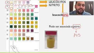 Bioquímica III - Exame químico da urina - Leucócitos e nitrito