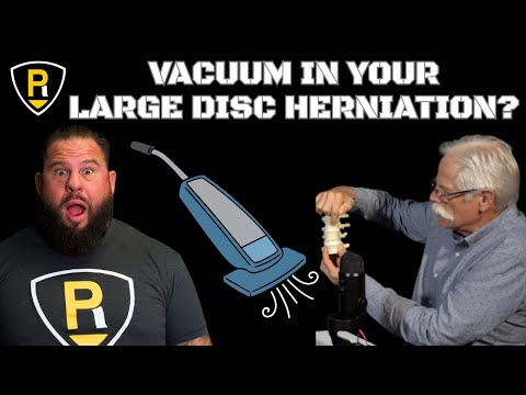 Large Disc Bulges Heal Faster Than Small Ones? (Ft. Dr. Stuart McGill)