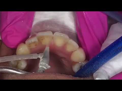 take a look thumbnail