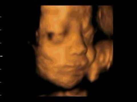 Denica Lian Villamosa