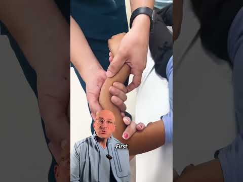 How Can Re-Breaking Bones Fix A Fracture⁉️ #shorts