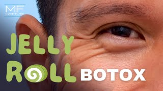 BOTOX® for Under Eye Bulging a.k.a. Jelly Roll BOTOX® | Mabrie Facial Institute in San Francisco, CA