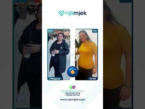 Një rezultat tjetër i mrekullueshëm i ngushtimit të stomakut | Njihuni me Elvire!