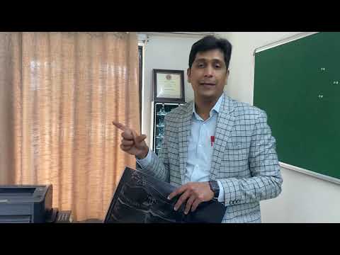 Spinal infection tuberculosis : Treated without surgery : Role of biopsy Dr Ajay kothari Spine Pune
