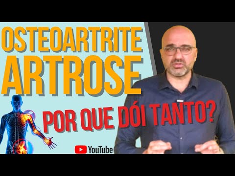 7 coisas que VOCÊ precisa SABER sobre ARTROSE / OSTEOARTRITE