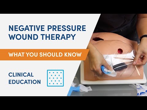 Negative Pressure Wound Therapy | Clinical Education