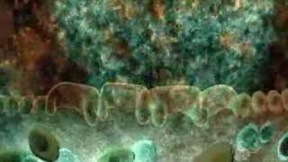 The Acquired Immune System