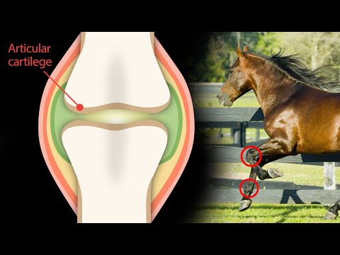 A bokaízület deformáló artrózisa 2-3 fokkal