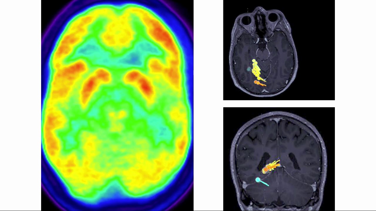 Ángel Aledo Serrano-7