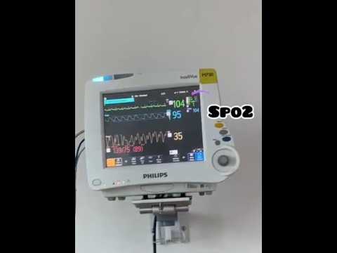 Understanding ICU Monitor parameters!!