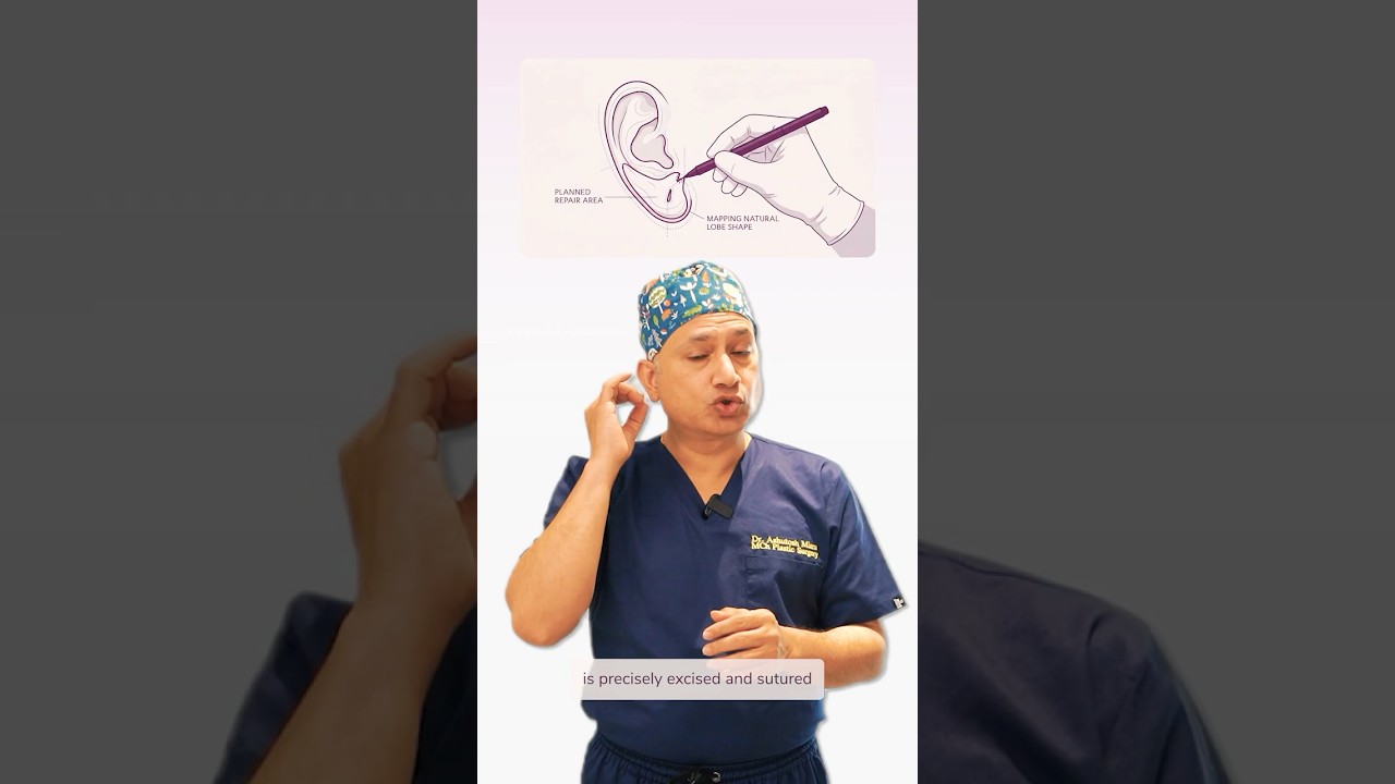 ⏱️ Earlobe Repair Explained in 30 Seconds