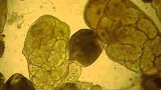 preview picture of video 'Trematodes in Lymnaea auricularia'