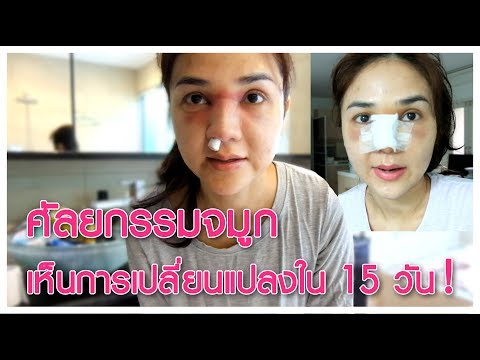 ถ้า 16 ปีหน้าอกเล็ก การออกกำลังกายเพื่อเพิ่มหน้าอก