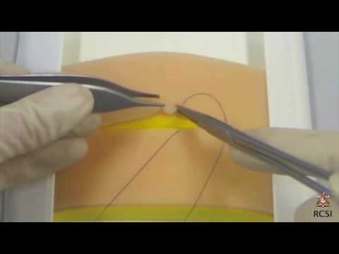 Subcuticular suture