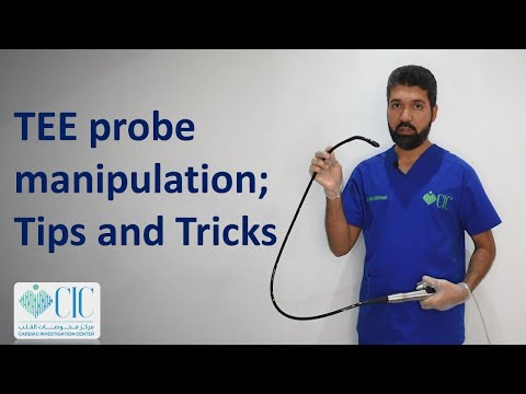 TEE (TOE) probe manipulation; tips and tricks