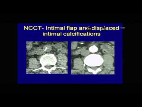 CARDIO RADIOLOGY CME PART 3