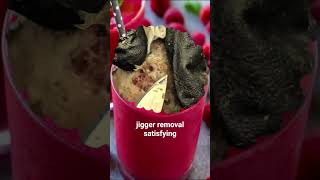 jigger removal satisfying ☠️☠️ #fyp