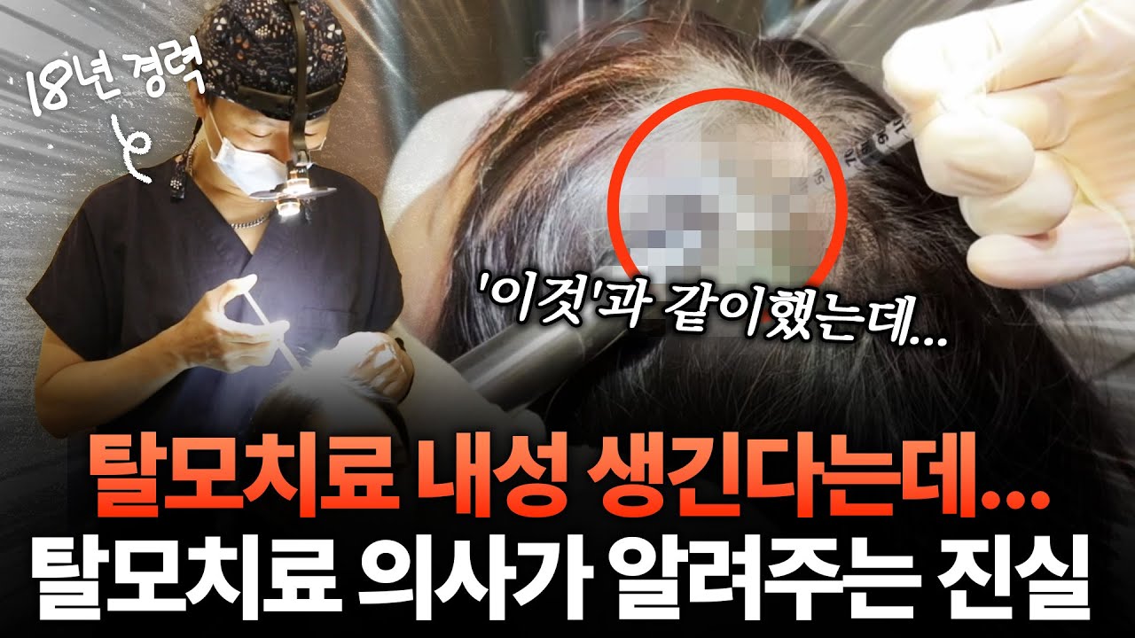 탈모치료 내성, 부작용.. '이것'과 같이하면 됩니다